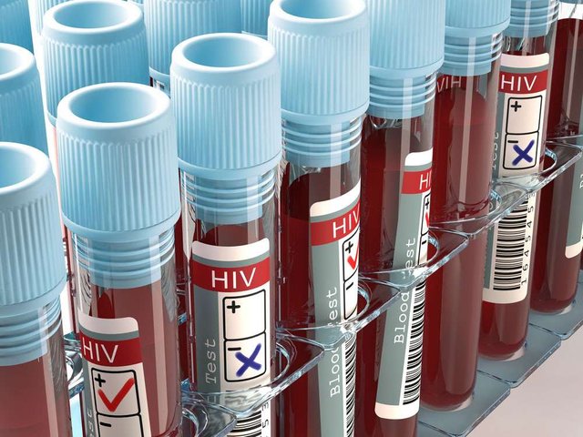 Image-concept-result-AIDS-HIV-test.jpg