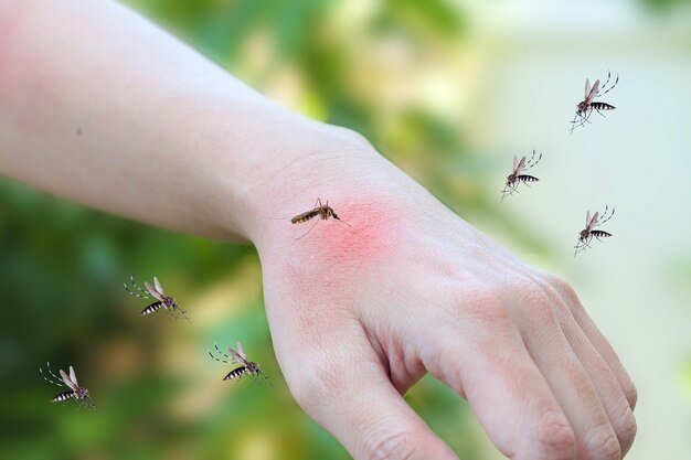 mosquitoes-bite-adult-hand-made-skin-rash-allergy-with-red-spot_293060-5007.jpg