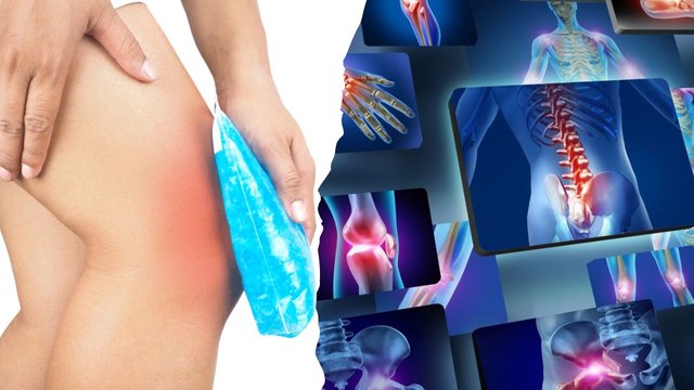 Arthritis Home Remedies to Treat This Condition.jpg