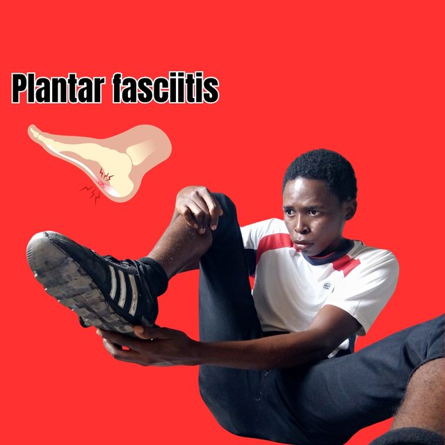 Plantar fasciitis_20241128_191253_0003.jpg