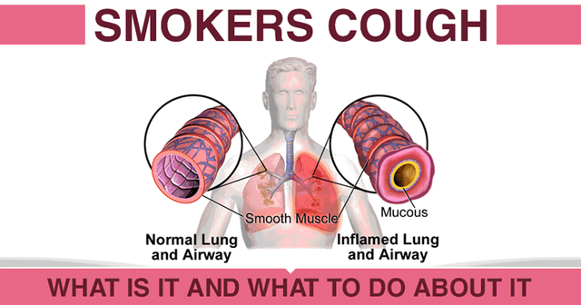 Smokers-Cough.png