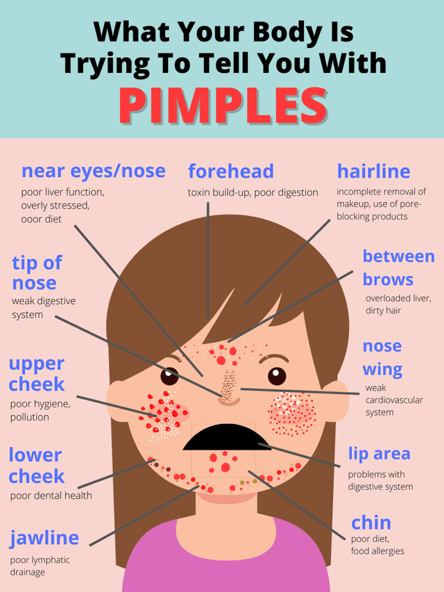 What-Your-Body-Is-Trying-To-Tell-You-With-acne-2-1152x1536.png