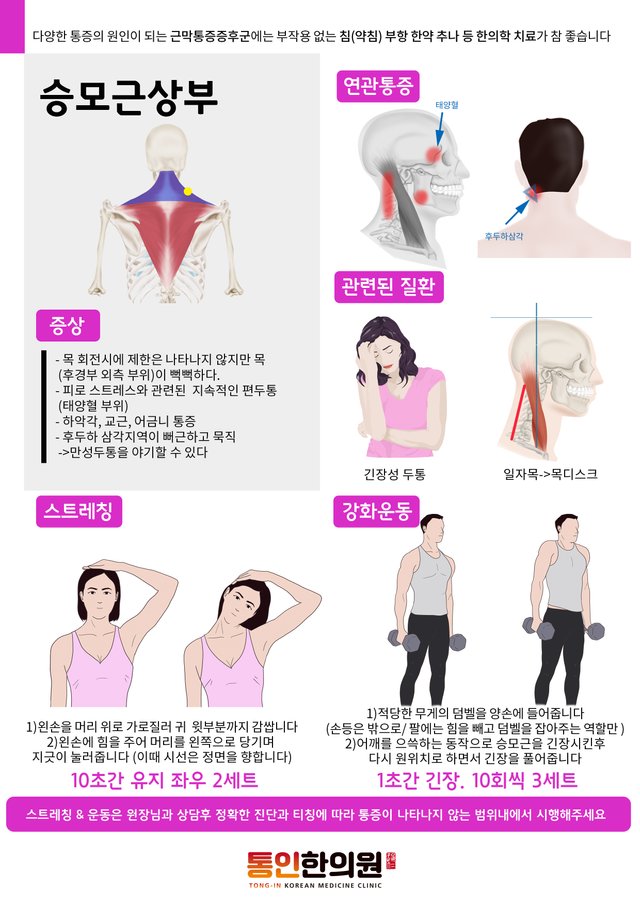 11)[근육처방전]승모근상부 통인한의원 처방전.jpg