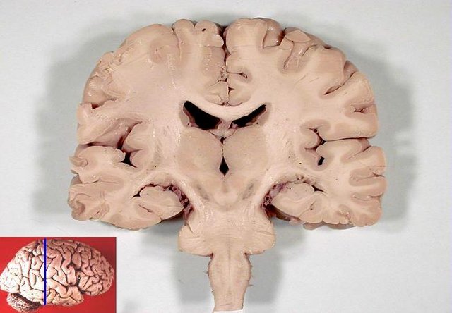 Human_brain_frontal_(coronal)_section.jpg