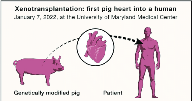 Worlds-first-pig-to-human-heart-transplant-performed-on-January-7-2022.png