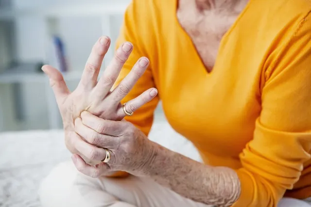 osteoarthritis-hand.webp