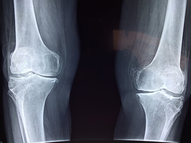 knee-g8b7e6b783_1920.jpg