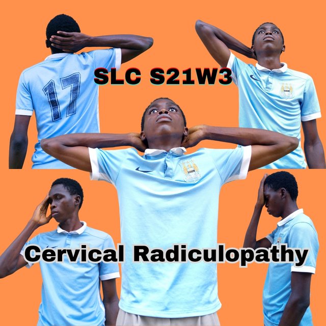 Cervical Radiculopathy_20241116_171718_0000.jpg