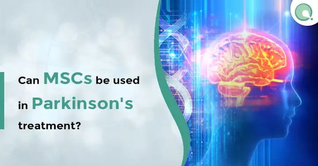 Can-MSCs-be-used-in-Parkinsons-treatment.jpg