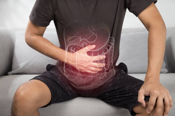 Irritable Bowel Syndrome.jpg