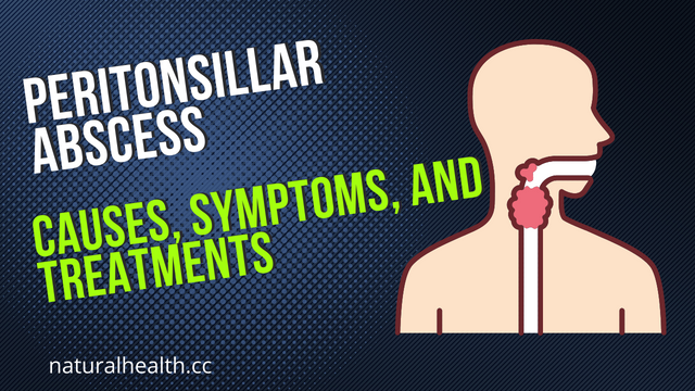 peritonsillar abscess.png