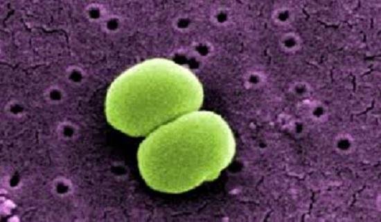 Staphylococcus-epidermidis.jpg