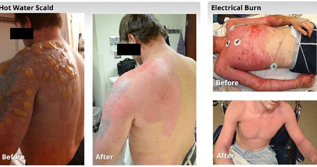 4005A9DB00000578-0-US_doctors_are_using_a_new_technique_that_allows_patients_to_reg-m-69_1494114516246.jpg