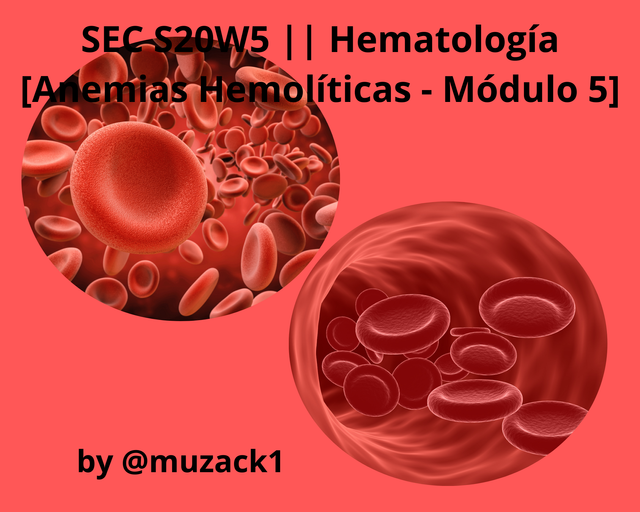 Penjelasan Kasus Anemia Hemolítica.png