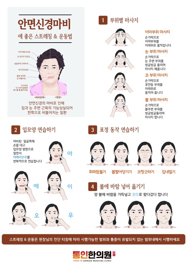 11포스터안면신경마비에_좋은_운동(a4).jpg