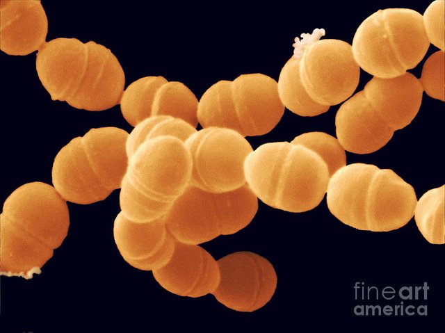 Streptococcus Thermophilus.jpg