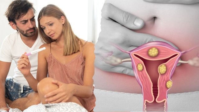 Infertility Heartache and Uterine Fibroids.jpg