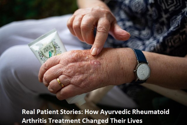 neeraj arthritis treatment 38.jpg