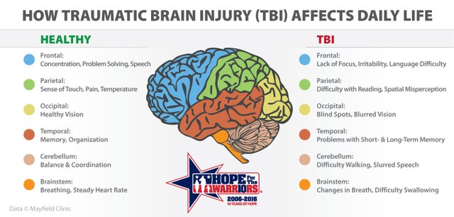 New Rules For Veterans Disability Related To Brain Injury Tbi Steemit