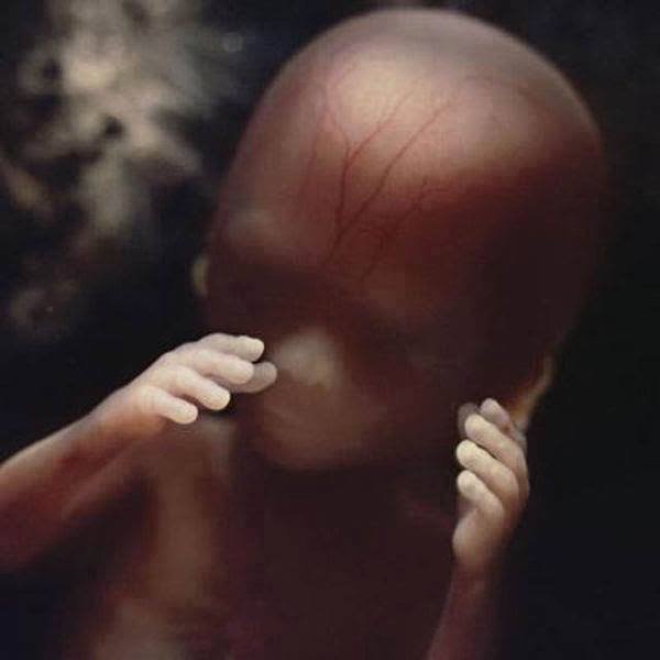16 weeks.The foetus uses its hands to explore its own body and its surroundings.jpg