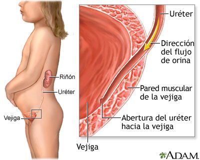 Infeccion_urinaria.jpg