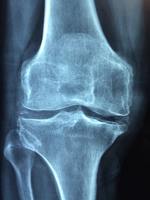 knee-g955bbf4ed_640.jpg