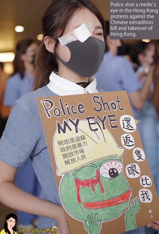 police shot medics eye.jpg