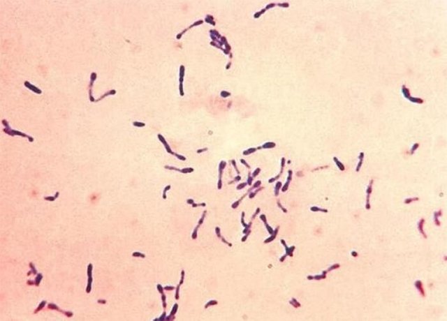 corynebacterium.jpg