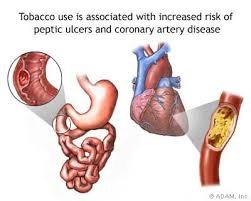 kolesterol dan rokok.jpg