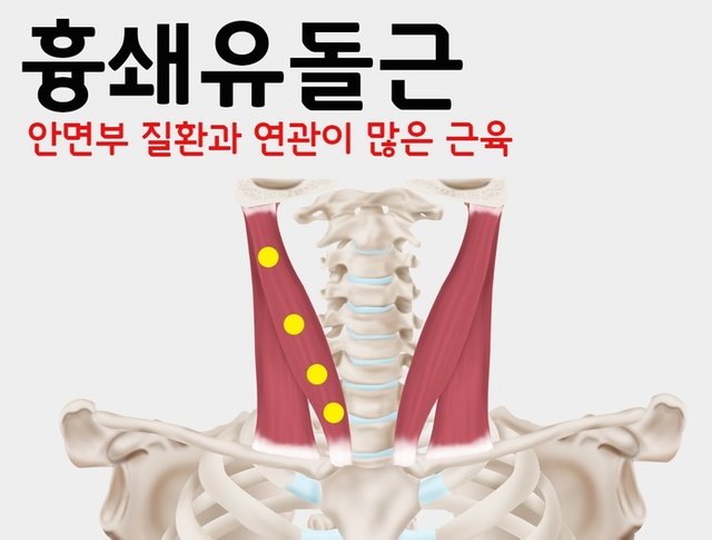 SCM 흉쇄유돌근.jpg