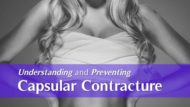 botched capsular contracture.jpg