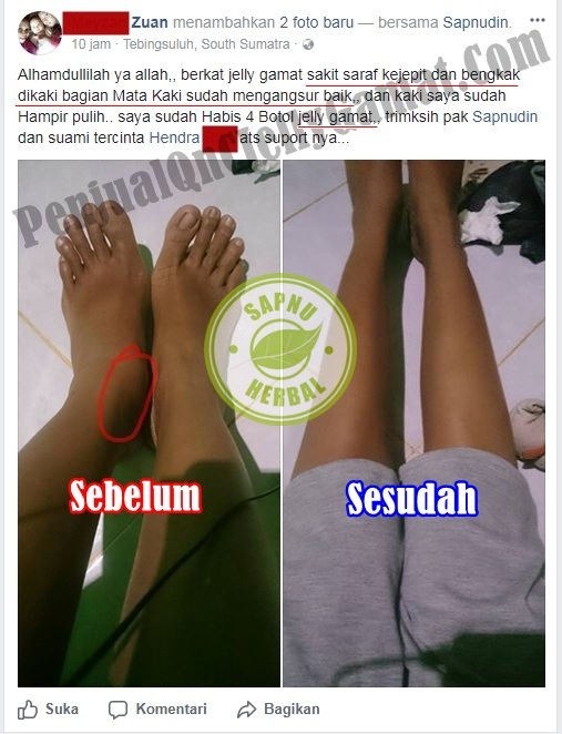 Testimoni QNC Jelly Gamat ~ Syaraf kejepit - penyakit syaraf tulang dan sendi.jpg