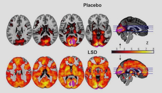 9a-this-is-your-brain-on-lsd.jpg