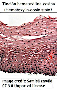 squamous2 cells in the esophagus,normal stain Samir@enwiki 3.0.jpg
