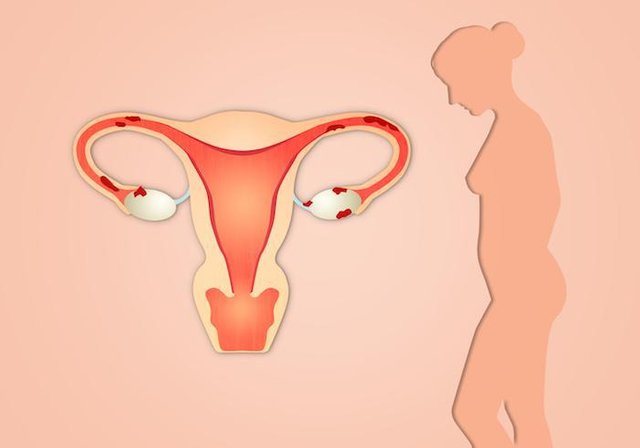 Conceiving Tips For Women With Uterine Fibroids.jpg