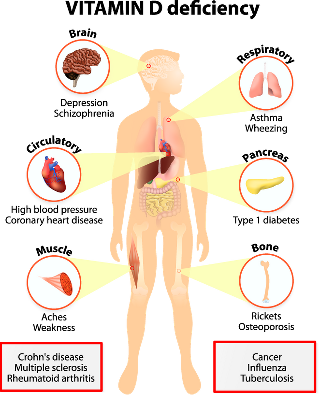 d-vitamini-eksikligi.png