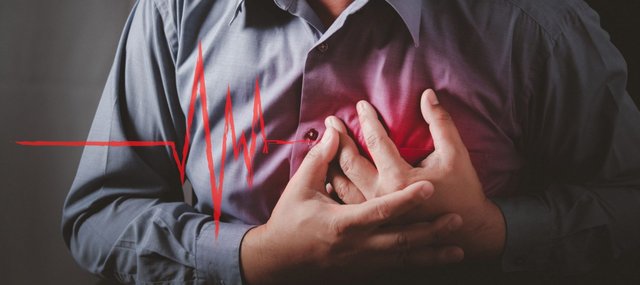 Everything You Need to Know About Arrhythmia.jpg