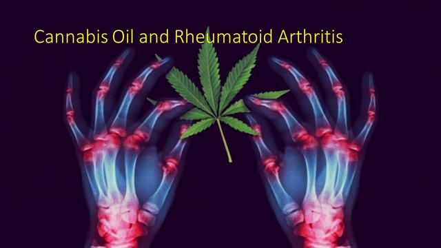 Rheumatoid-Arthritis-.jpg