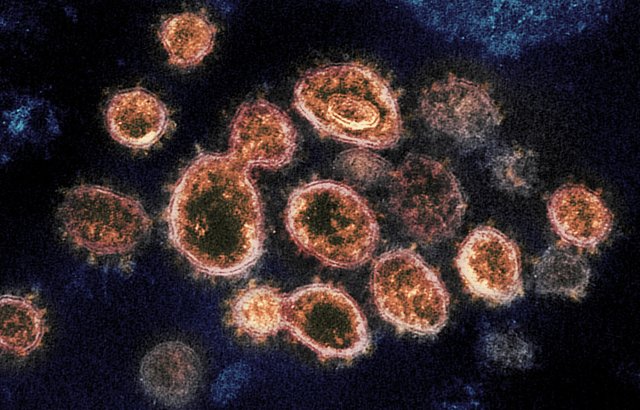 Coronavirus.jpg