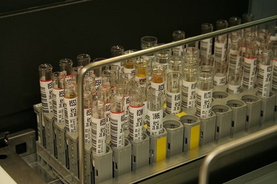 tube-blood-urine-lab.jpg