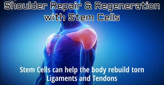 shoulder repair and regeneration with stem cells at dreambody clinic.jpg