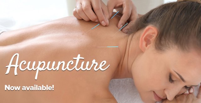 Acupuncture Therapy 9.jpg