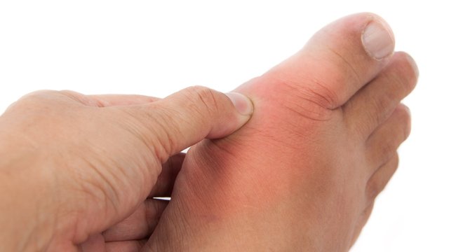 This is the Most Effective Holistic Treatment for Gout.jpg