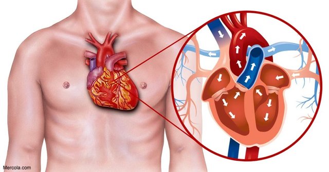 Heart-Blockage-Treated-1024x538.jpg