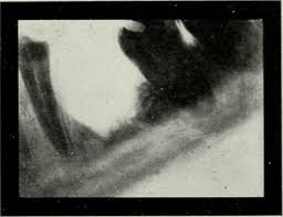 Radiographic Film.jpg
