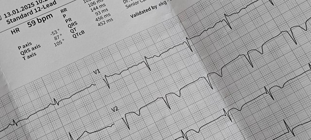 EKG.jpg