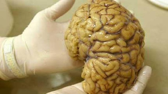 LabGrownBrains-905x509.jpg