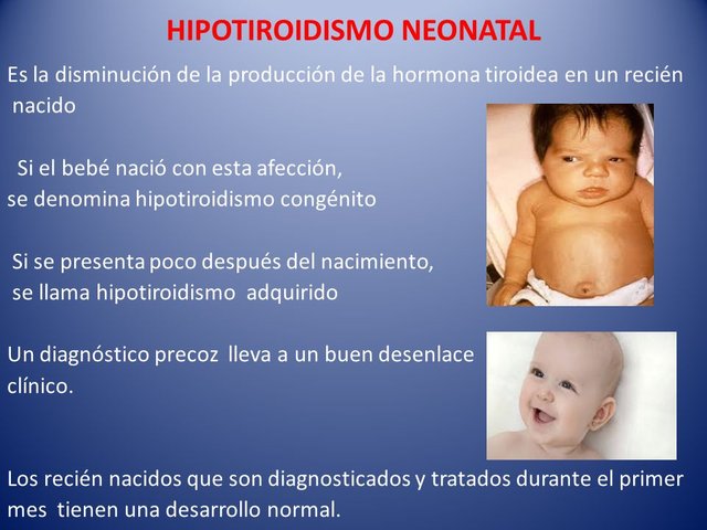 HIPOTIROIDISMO+NEONATAL.jpg