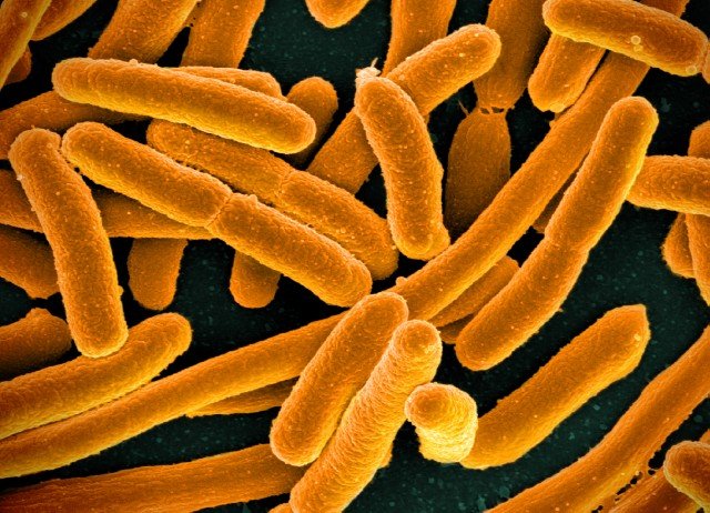 E._coli_Bacteria_(16598492368).jpg