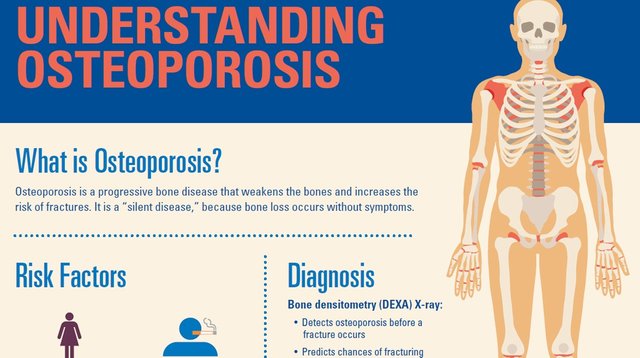 What is Osteoporosis.jpg